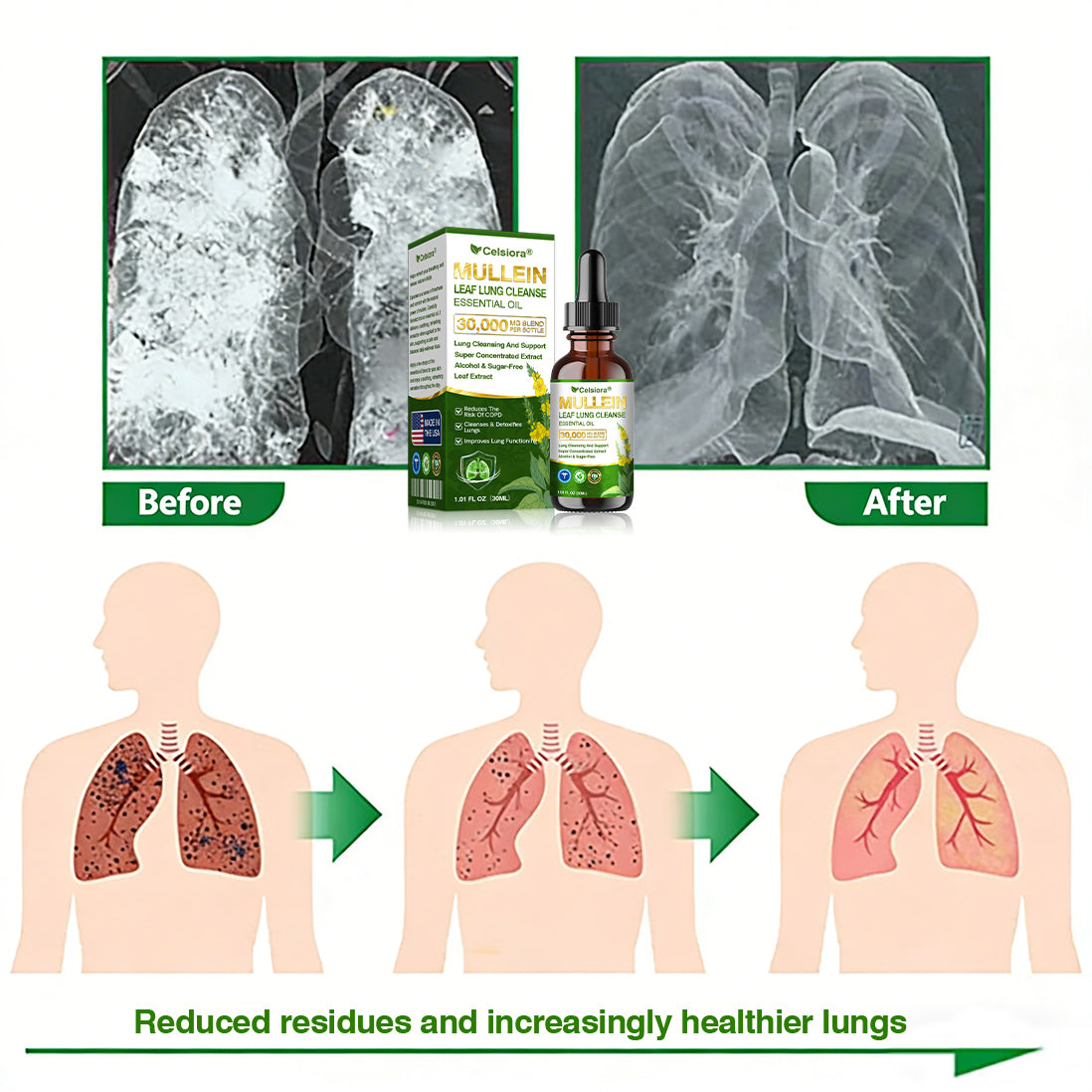 💝✅𝐔𝐒 𝐎𝐟𝐟𝐢𝐜𝐢𝐚𝐥 𝐒𝐭𝐨𝐫𝐞|𝐂𝐞𝐥𝐬𝐢𝐨𝐫𝐚® 𝐎𝐫𝐠𝐚𝐧𝐢𝐜 𝐌𝐮𝐥𝐥𝐞𝐢𝐧 𝐋𝐞𝐚𝐟 𝐋𝐮𝐧𝐠 𝐂𝐥𝐞𝐚𝐧𝐬𝐞 𝐄𝐬𝐬𝐞𝐧𝐭𝐢𝐚𝐥 𝐎𝐢𝐥 (💖Cough, wheezing, shortness of breath, sputum, stuffy nose, bronchitis, bronchitis, allergy symptoms, lung discomfort💝)