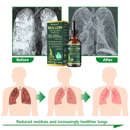 ✅𝐔𝐒 𝐎𝐟𝐟𝐢𝐜𝐢𝐚𝐥 𝐒𝐭𝐨𝐫𝐞|𝐂𝐞𝐥𝐬𝐢𝐨𝐫𝐚® 𝐎𝐫𝐠𝐚𝐧𝐢𝐜 𝐌𝐮𝐥𝐥𝐞𝐢𝐧 𝐋𝐞𝐚𝐟 𝐋𝐮𝐧𝐠 𝐂𝐥𝐞𝐚𝐧𝐬𝐞 𝐄𝐬𝐬𝐞𝐧𝐭𝐢𝐚𝐥 𝐎𝐢𝐥 (🫁Cough, wheezing, shortness of breath, sputum, stuffy nose, bronchitis, bronchitis, allergy symptoms, lung discomfort💝)