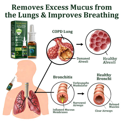 🍃✅US Official Store:CareBreeze® 6-in-1 Herbal BeePropolis Lung Cleanse Spray（👨‍⚕️Directly acts on COPD, asthma, chronic bronchitis (CB), respiratory infections, lung cancer, sinusitis, and other conditions）