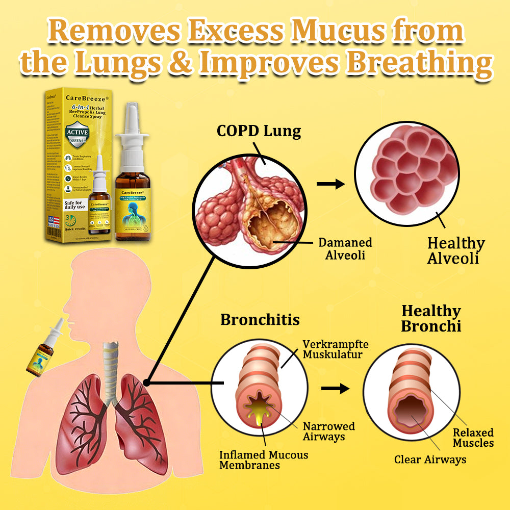 🫁🐝✅US Official Store:CareBreeze® 6-in-1 Herbal BeePropolis Lung Cleanse Spray（👨‍⚕️Directly acts on COPD, asthma, chronic bronchitis (CB), respiratory infections, lung cancer, sinusitis, and other conditions）