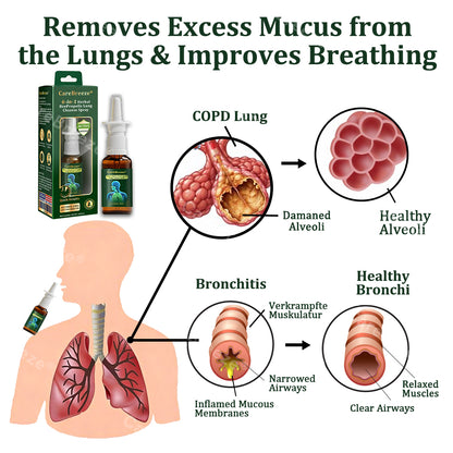 💚US Official Store:CareBreeze® 6-in-1 Herbal BeePropolis Lung Cleanse Spray🐝（👨‍⚕️Directly acts on COPD, asthma, chronic bronchitis (CB), respiratory infections, lung cancer, sinusitis, and other conditions）