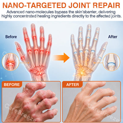 🦵✅🇺🇸 CareBreeze® Pain-Relief Bone-Healing Microneedle Patch(🧑‍⚕️Reducing joint swelling, pain, stiffness, redness, warmth, soreness, and joint fatigue)