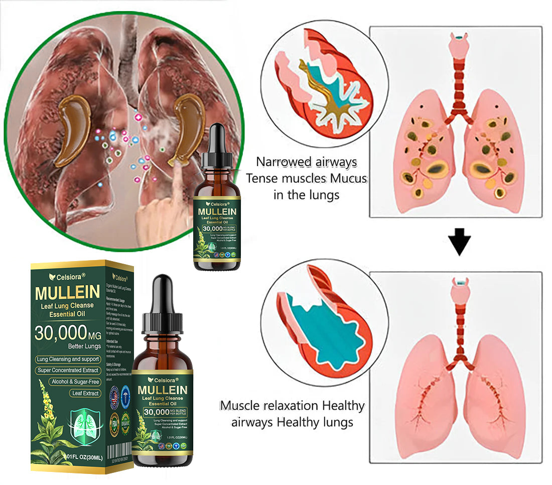 ✅𝐔𝐒 𝐎𝐟𝐟𝐢𝐜𝐢𝐚𝐥 𝐒𝐭𝐨𝐫𝐞|𝐂𝐞𝐥𝐬𝐢𝐨𝐫𝐚® 𝐎𝐫𝐠𝐚𝐧𝐢𝐜 𝐌𝐮𝐥𝐥𝐞𝐢𝐧 𝐋𝐞𝐚𝐟 𝐋𝐮𝐧𝐠 𝐂𝐥𝐞𝐚𝐧𝐬𝐞 𝐄𝐬𝐬𝐞𝐧𝐭𝐢𝐚𝐥 𝐎𝐢𝐥 (🫁Cough, wheezing, shortness of breath, sputum, stuffy nose, bronchitis, bronchitis, allergy symptoms, lung discomfort💝)