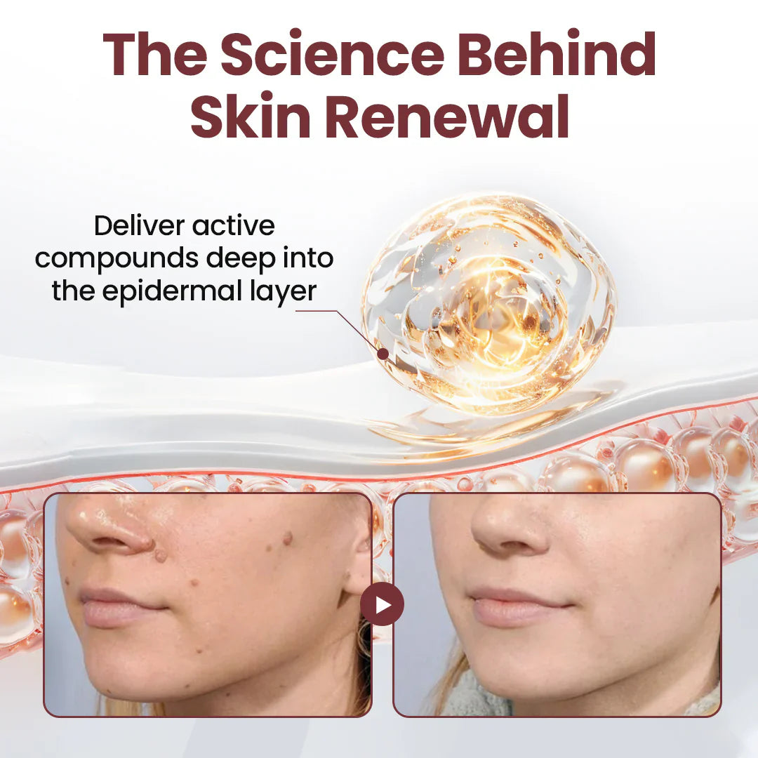 🐵✅US Owned and Operated：Pheromex®Dual-Action Plant Wart Removal Cream（👨‍⚕️Skin Tags,Acne,Hyperpigmentation,Eczema,Psoriasis,Rosacea,Warts)
