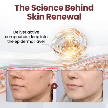 🐵✅US Owned and Operated：Pheromex®Dual-Action Plant Wart Removal Cream（👨‍⚕️Skin Tags,Acne,Hyperpigmentation,Eczema,Psoriasis,Rosacea,Warts)