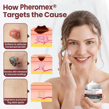 🐵✅US Owned and Operated：Pheromex®Dual-Action Plant Wart Removal Cream（👨‍⚕️Skin Tags,Acne,Hyperpigmentation,Eczema,Psoriasis,Rosacea,Warts)