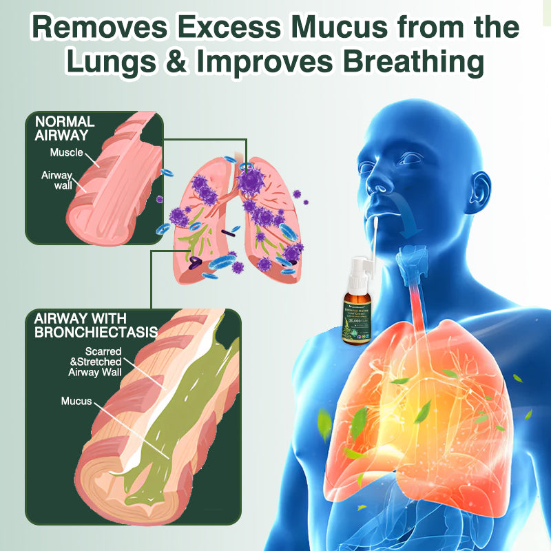 ⚡⚡✅US Official Store:CareBreeze® Botanical Mullein Leaf Extract Lung Cleanse Spray（👨‍⚕️Directly acts on COPD, asthma, chronic bronchitis (CB), respiratory infections, lung cancer, sinusitis, and other conditions）