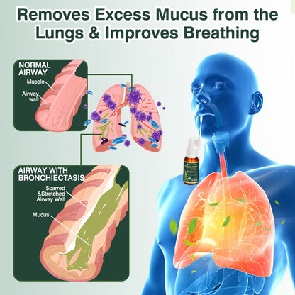 ⚡⚡✅US Official Store:CareBreeze® Botanical Mullein Leaf Extract Lung Cleanse Spray（👨‍⚕️Directly acts on COPD, asthma, chronic bronchitis (CB), respiratory infections, lung cancer, sinusitis, and other conditions）