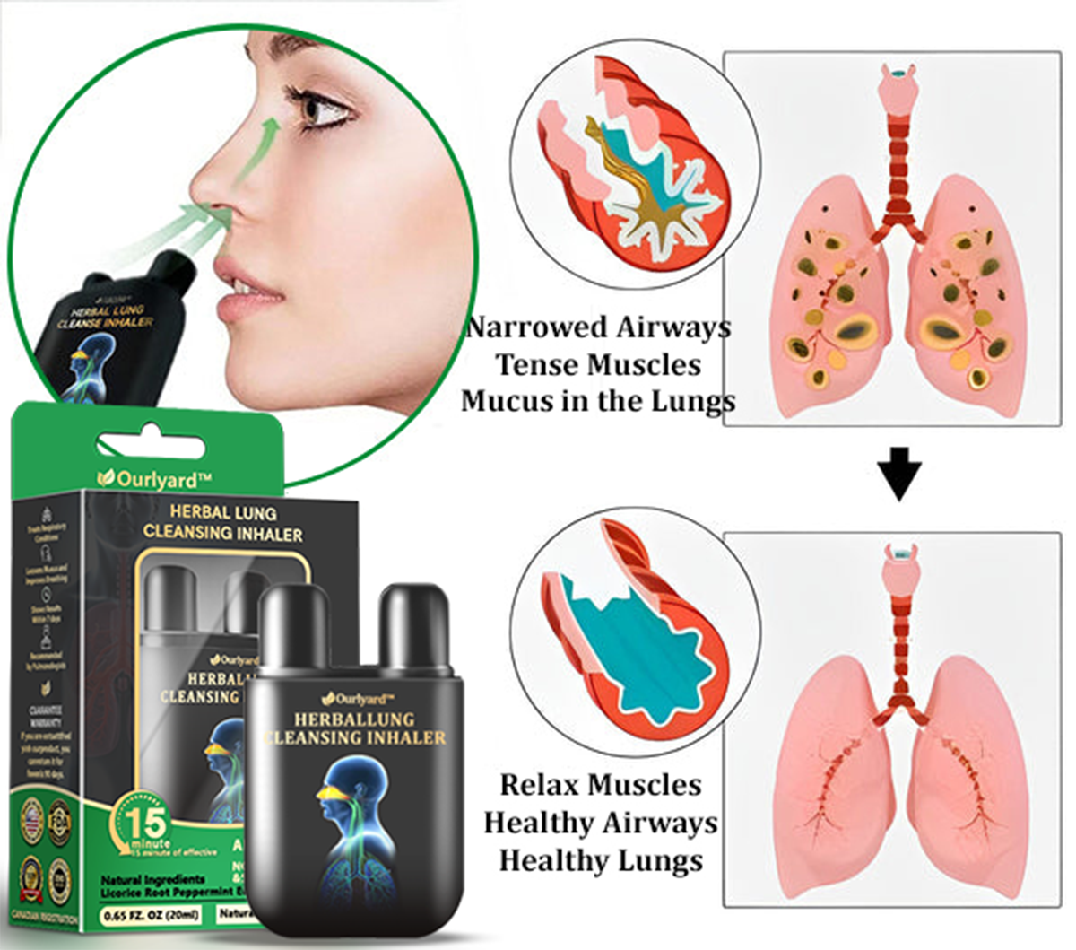 🦙✅Official Store|Ourlyard™ Herbal Lung Cleansing Inhaler(💝 Cough, wheezing, shortness of breath, sputum, stuffy nose, bronchitis, bronchitis, allergy symptoms, lung discomfort💝)