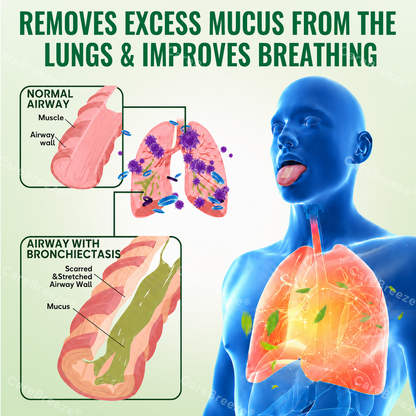 🇺🇸 ✅CareBreeze® Advanced Botanical Mullein Lung Cleanse Melt Strips（👨‍⚕️Directly acts on COPD, asthma, chronic bronchitis (CB), respiratory infections, lung cancer, sinusitis, and other conditions）