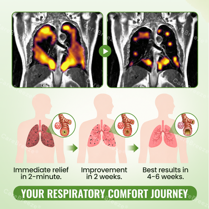 🇺🇸 ✅CareBreeze® Advanced Botanical Mullein Lung Cleanse Melt Strips（👨‍⚕️Directly acts on COPD, asthma, chronic bronchitis (CB), respiratory infections, lung cancer, sinusitis, and other conditions）