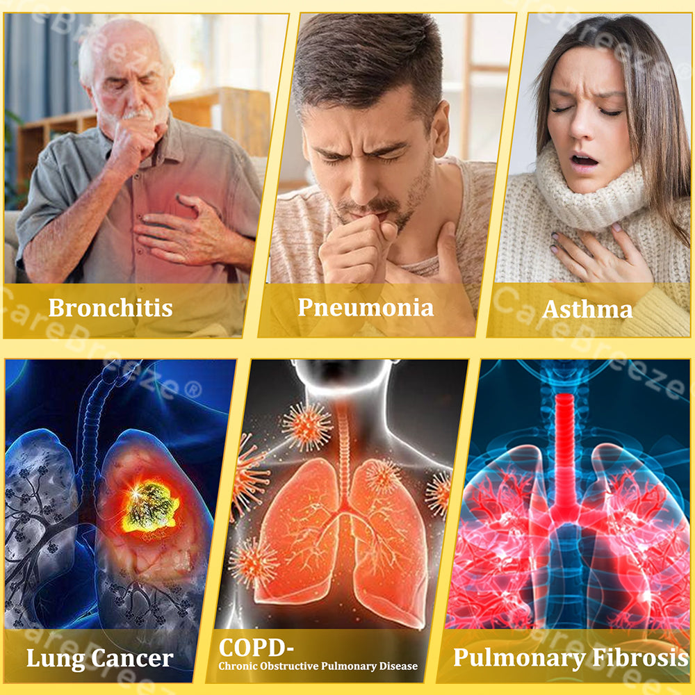 🐝🇺🇸 Official Store:CareBreeze® 6-in-1 Herbal BeePropolis Lung Cleanse Spray（👨‍⚕️Directly acts on COPD, asthma, chronic bronchitis (CB), respiratory infections, lung cancer, sinusitis, and other conditions🫁）
