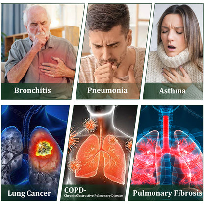 💚US Official Store:CareBreeze® 6-in-1 Herbal BeePropolis Lung Cleanse Spray🐝（👨‍⚕️Directly acts on COPD, asthma, chronic bronchitis (CB), respiratory infections, lung cancer, sinusitis, and other conditions）